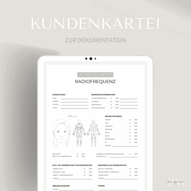 Kundenkartei für Radiofrequenz